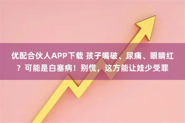 优配合伙人APP下载 孩子嘴破、尿痛、眼睛红？可能是白塞病！别慌，这方能让娃少受罪