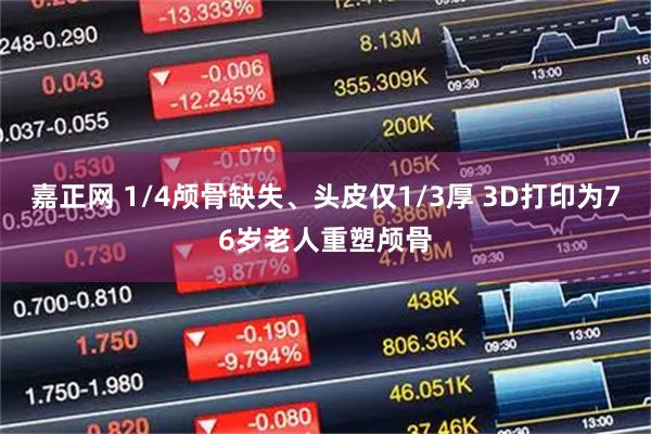 嘉正网 1/4颅骨缺失、头皮仅1/3厚 3D打印为76岁老人重塑颅骨